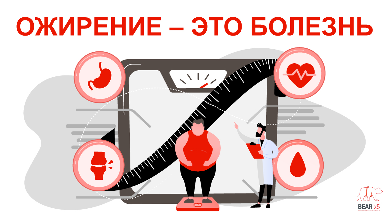 Ожирение - это болезнь